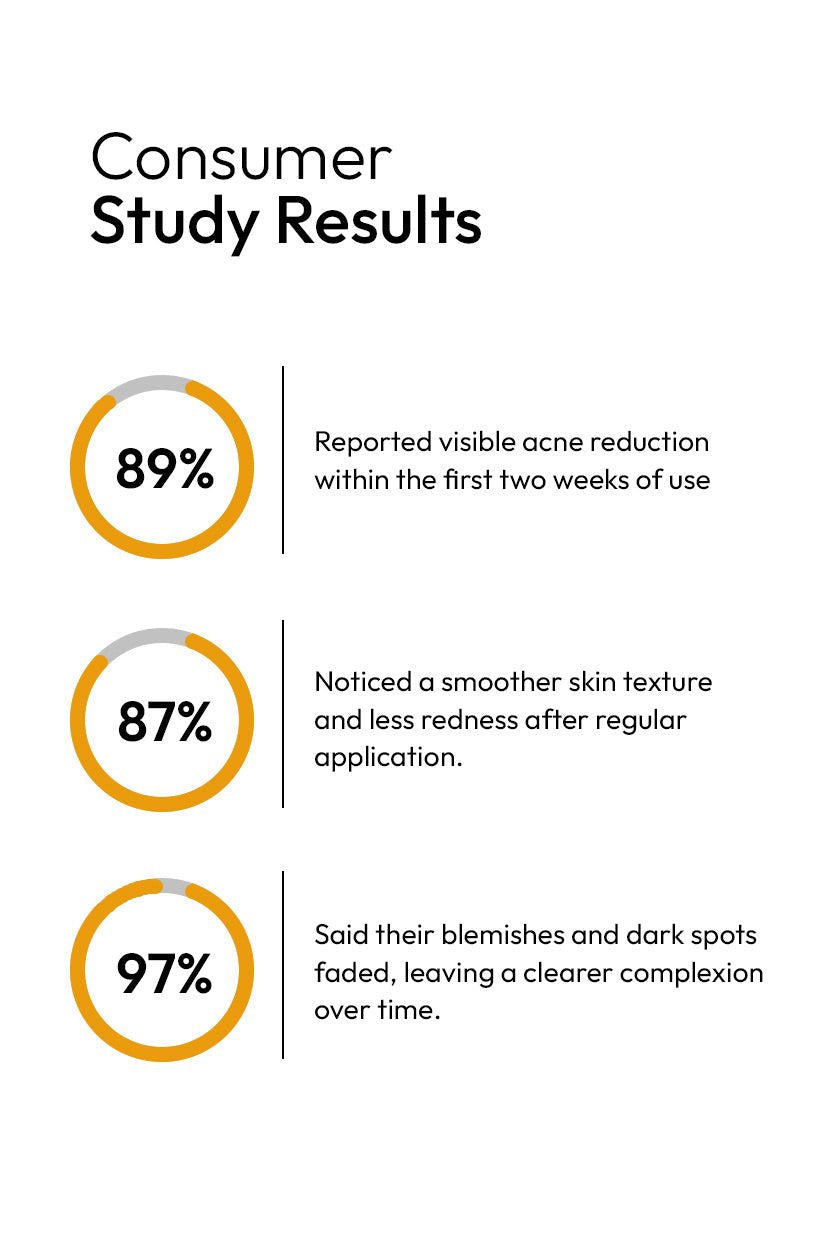 ANTI ACNE SERUM (30ml) (GURANTEED RESULTS IN 14-DAYS)
