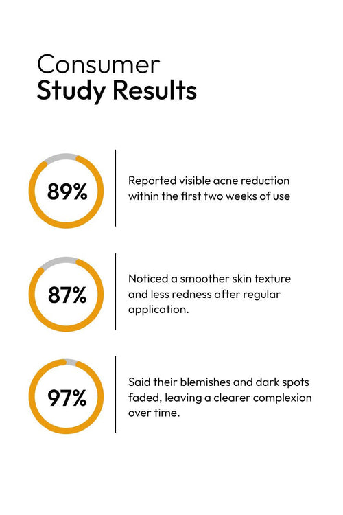ANTI ACNE SERUM (30ml) (GURANTEED RESULTS IN 14-DAYS)