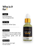 ANTI ACNE SERUM (30ml) (GURANTEED RESULTS IN 14-DAYS)